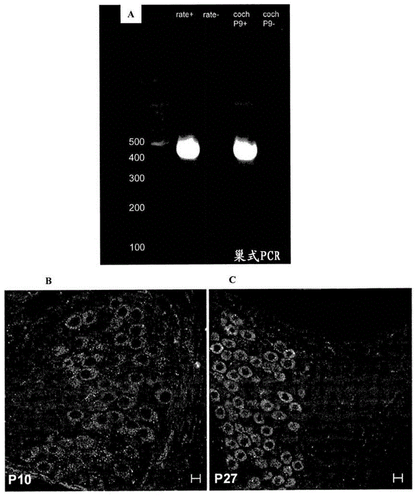 H4 receptor inhibitors for treating tinnitus