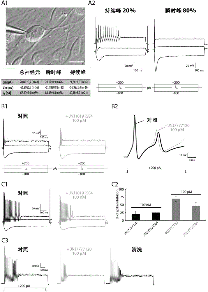 H4 receptor inhibitors for treating tinnitus