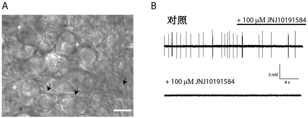 H4 receptor inhibitors for treating tinnitus