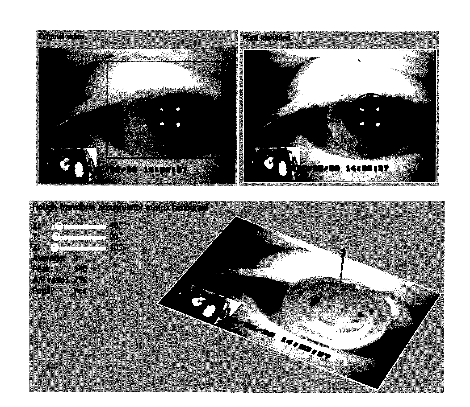 Filtering eye blink artifact from infrared videonystagmography