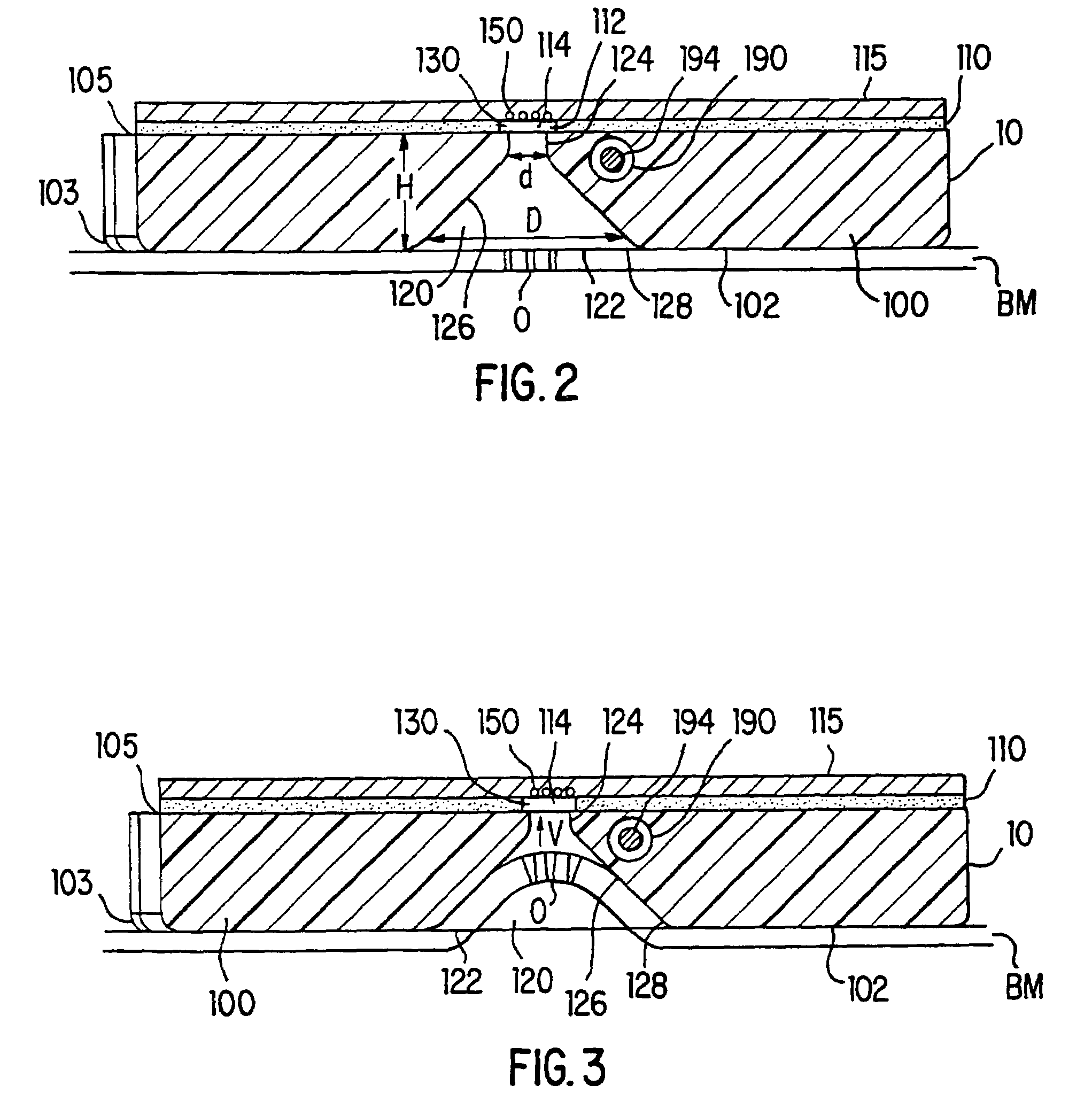 Tissue interface device