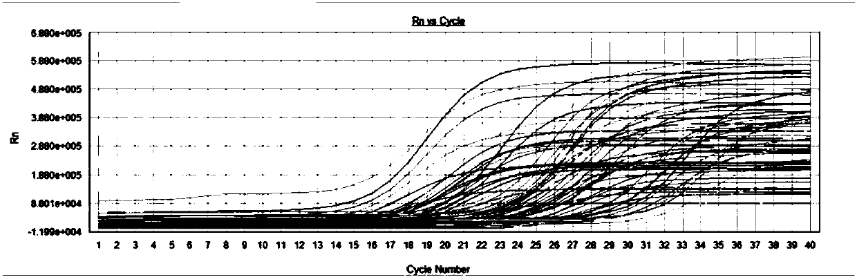 Primers, kit and method to detect circular DNA circRNA_101835 and their application