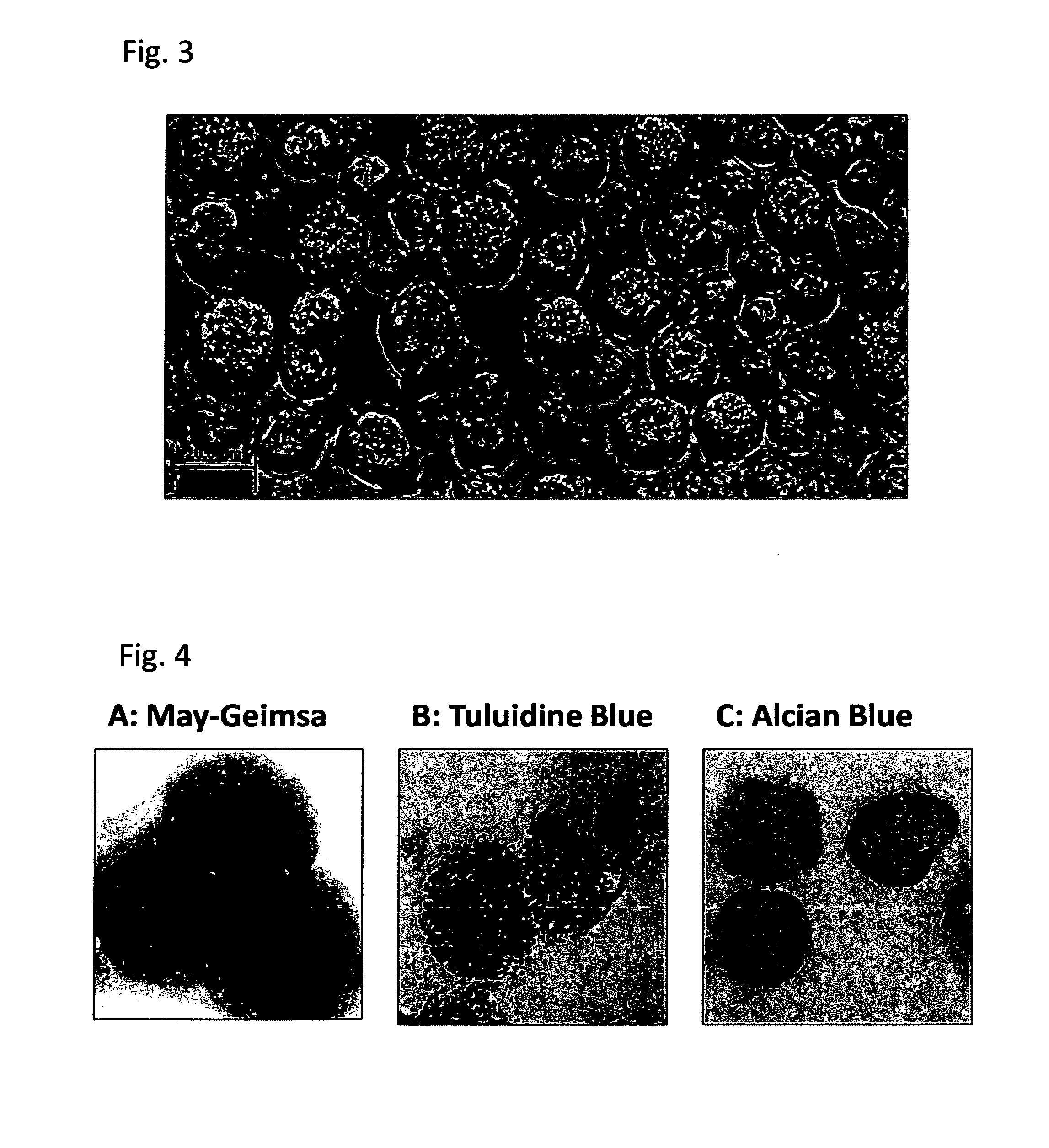 Method for producing mast cells from pluripotent stem cells