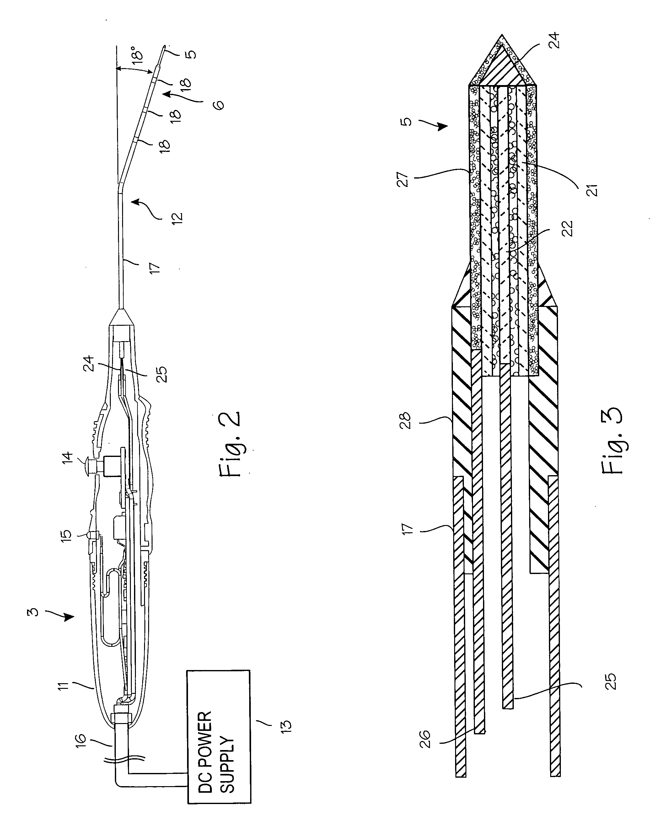 Resistive heating device and method for turbinate ablation