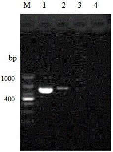 hmg1 Gene and Its Application in Molecular Detection of Microsporidium Bombyx mori