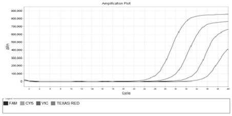 Method and kit for detecting type 2 diabetes mellitus susceptible intestinal bacteria