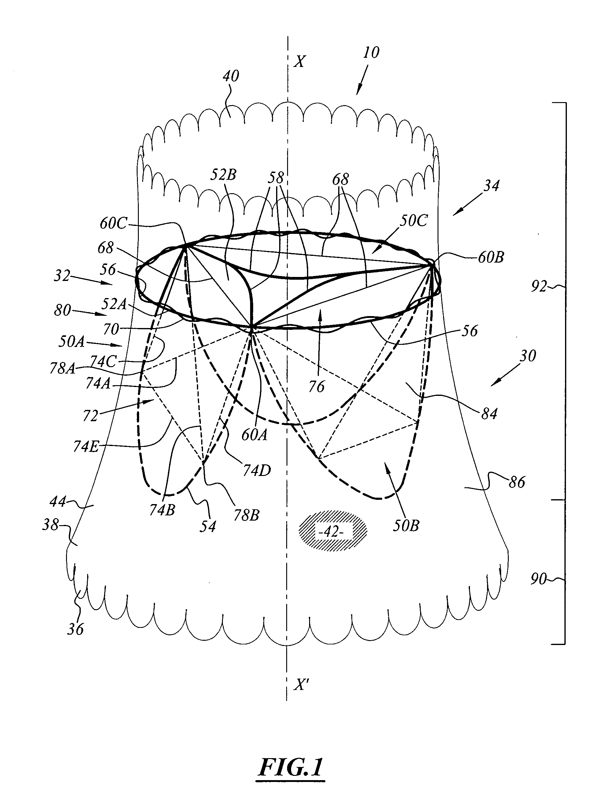 Implant for placing in a blood circulation conduit