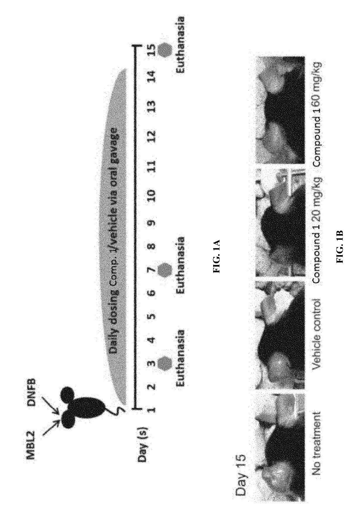 Methods of treating solid tumors with CCR2 antagonists