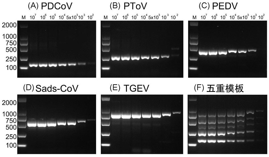 Quintuple RT-PCR detection method for the pathogen of porcine viral diarrhea