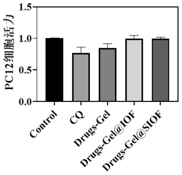 Preparation method of responsive drug carrier for spinal cord injury repair