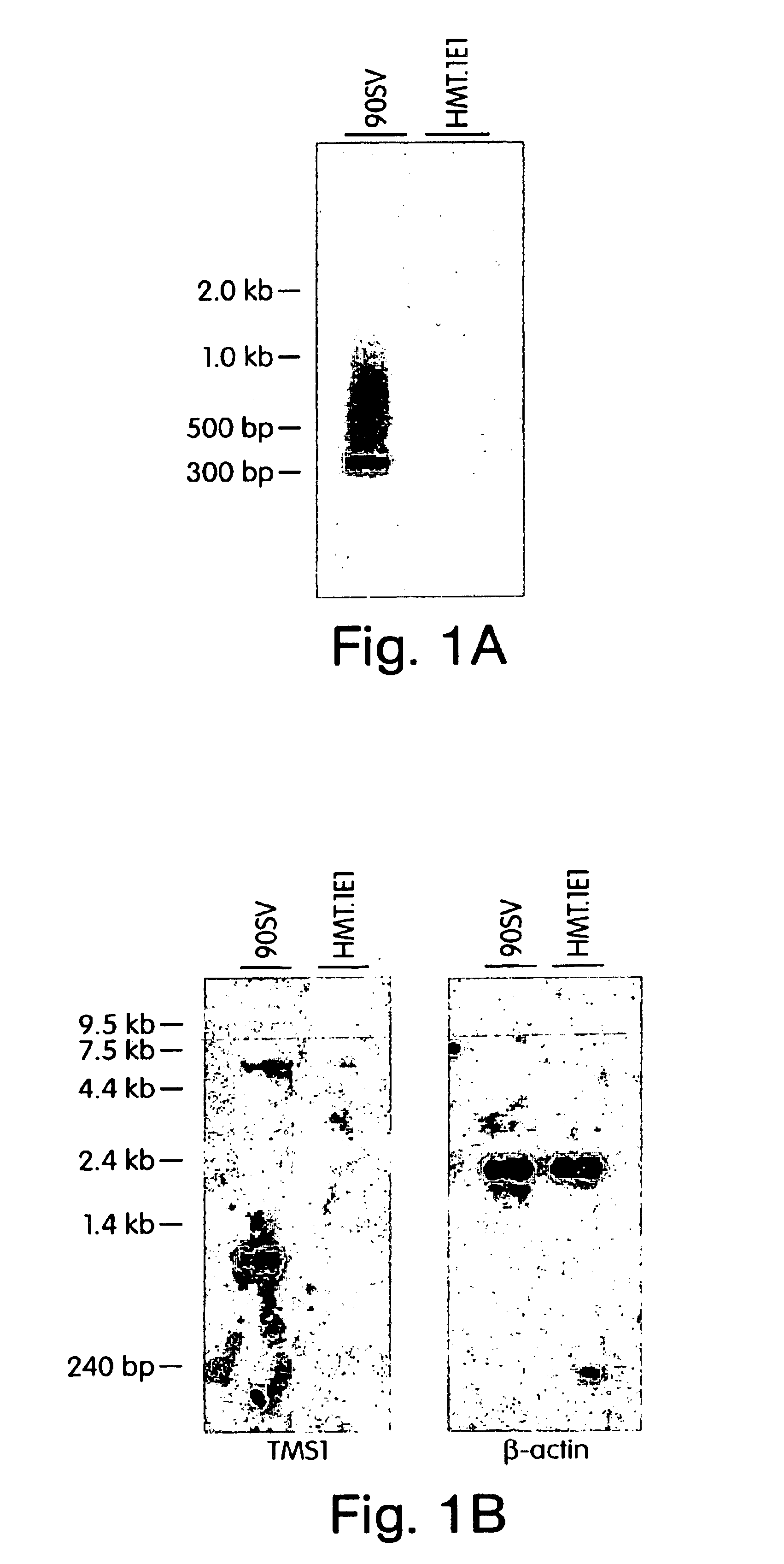 TMS1 compositions and methods of use
