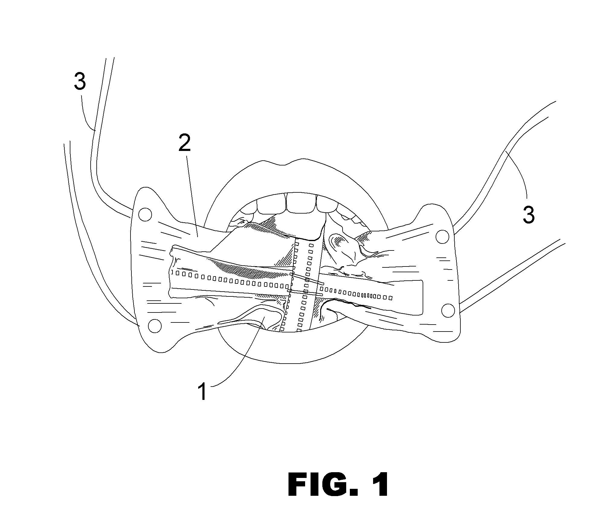 Dental Safety Device