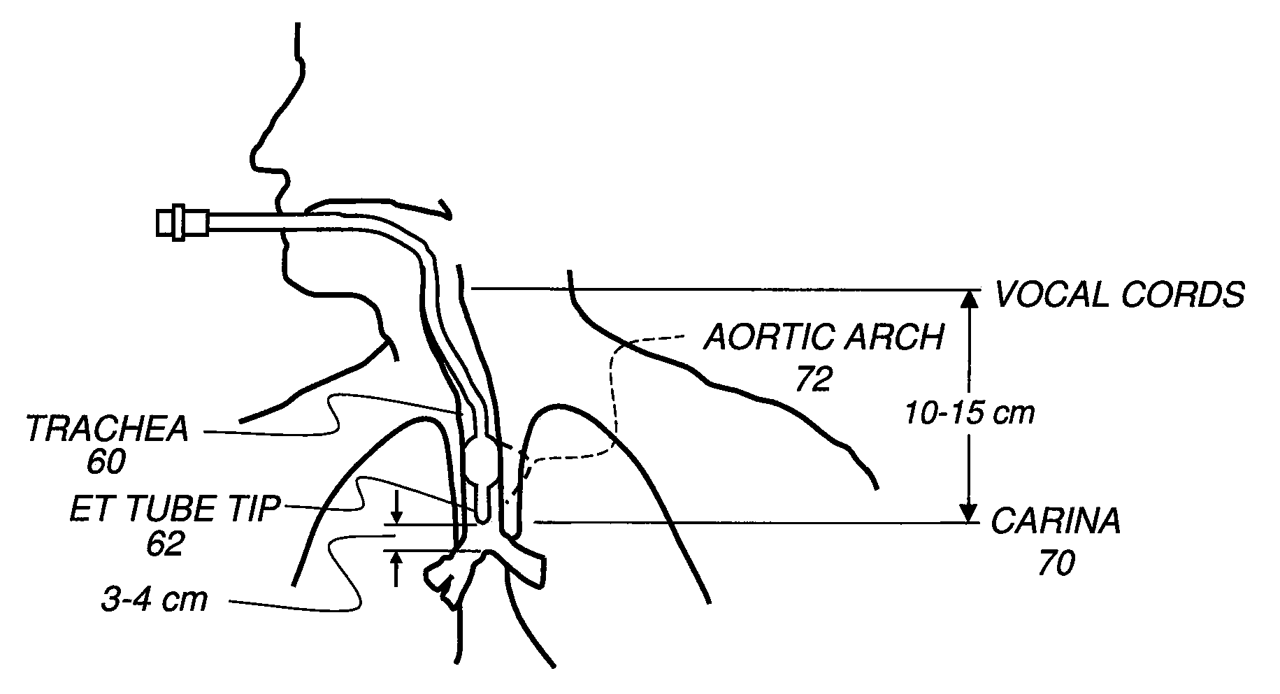 Method for detecting anatomical structures