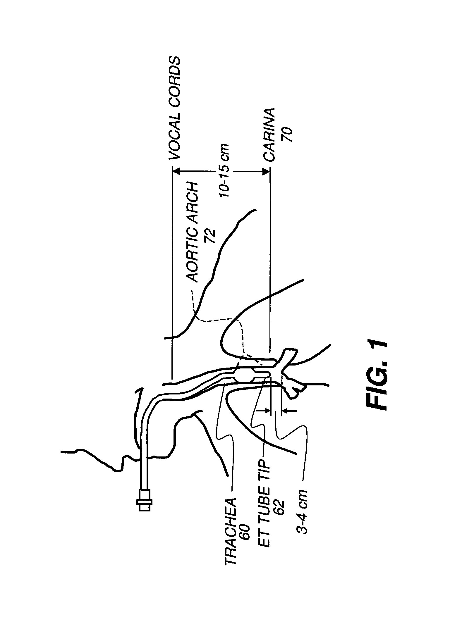 Method for detecting anatomical structures