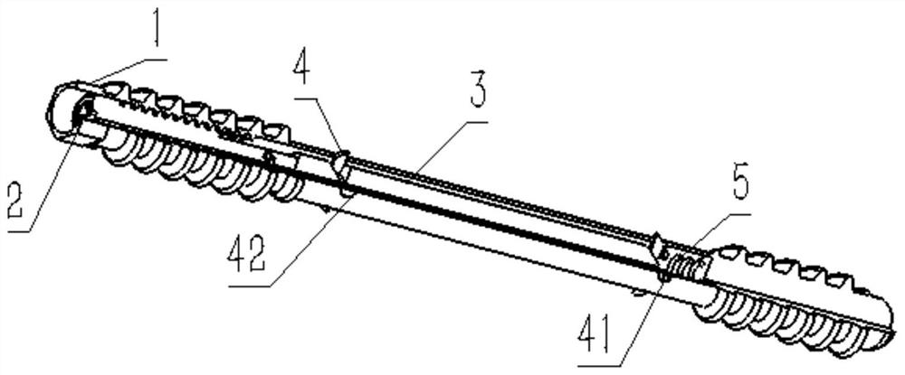 An anti-rotation orthopedic internal fixator