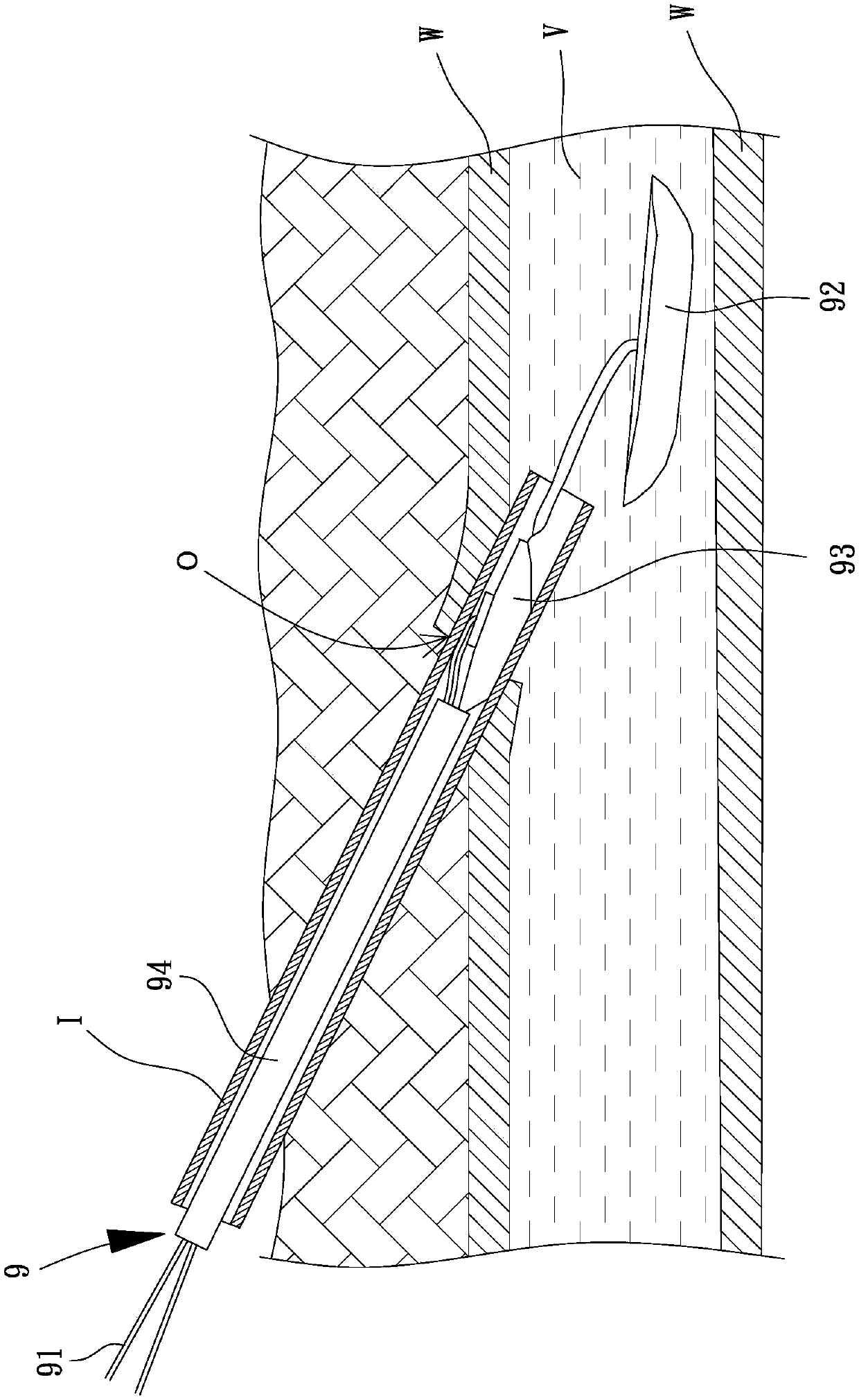 Vascular puncture sealing device