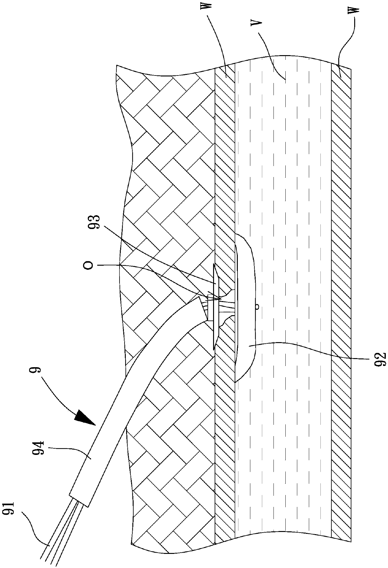 Vascular puncture sealing device