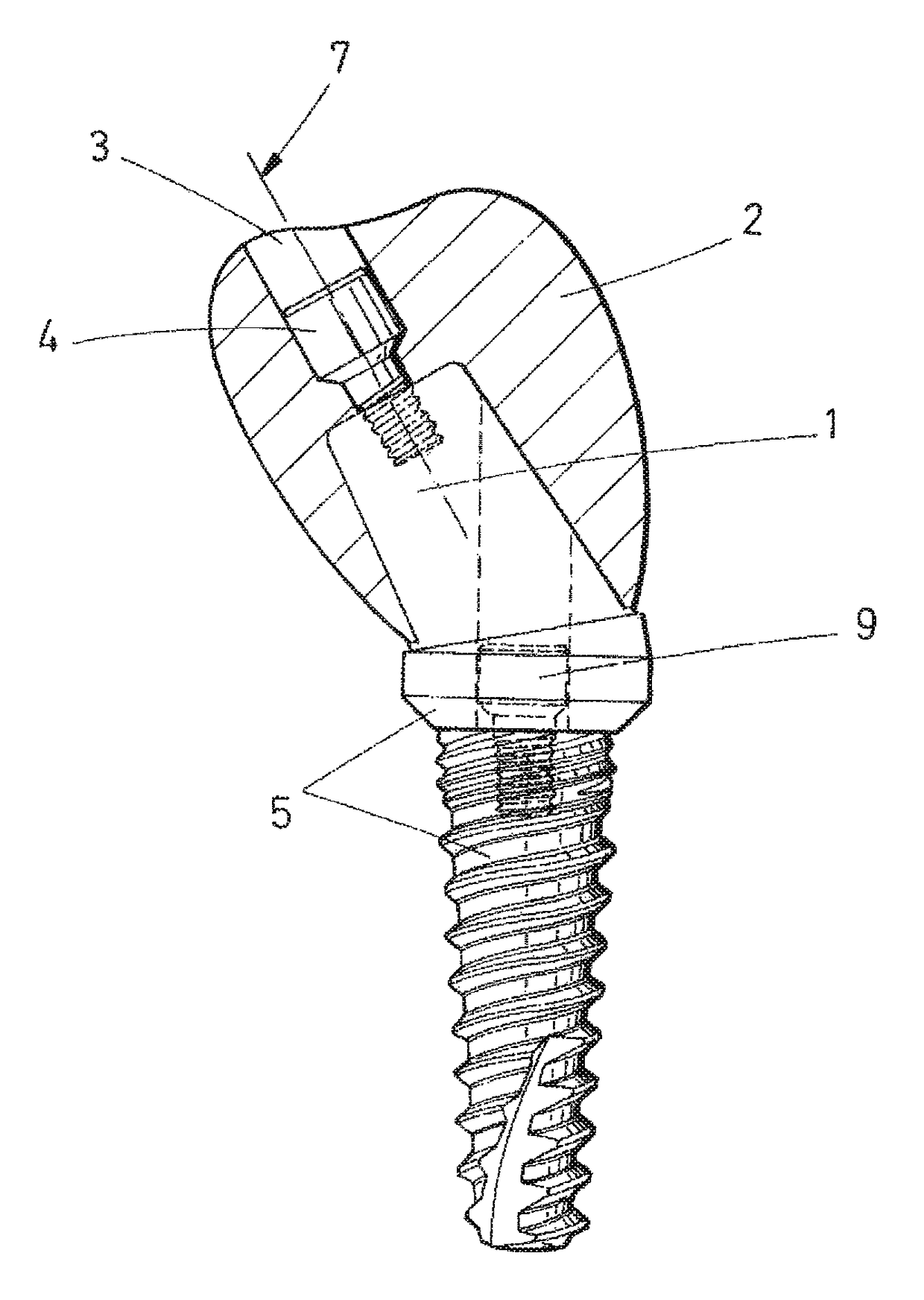 Dental post for supporting dental prostheses and method for the production thereof