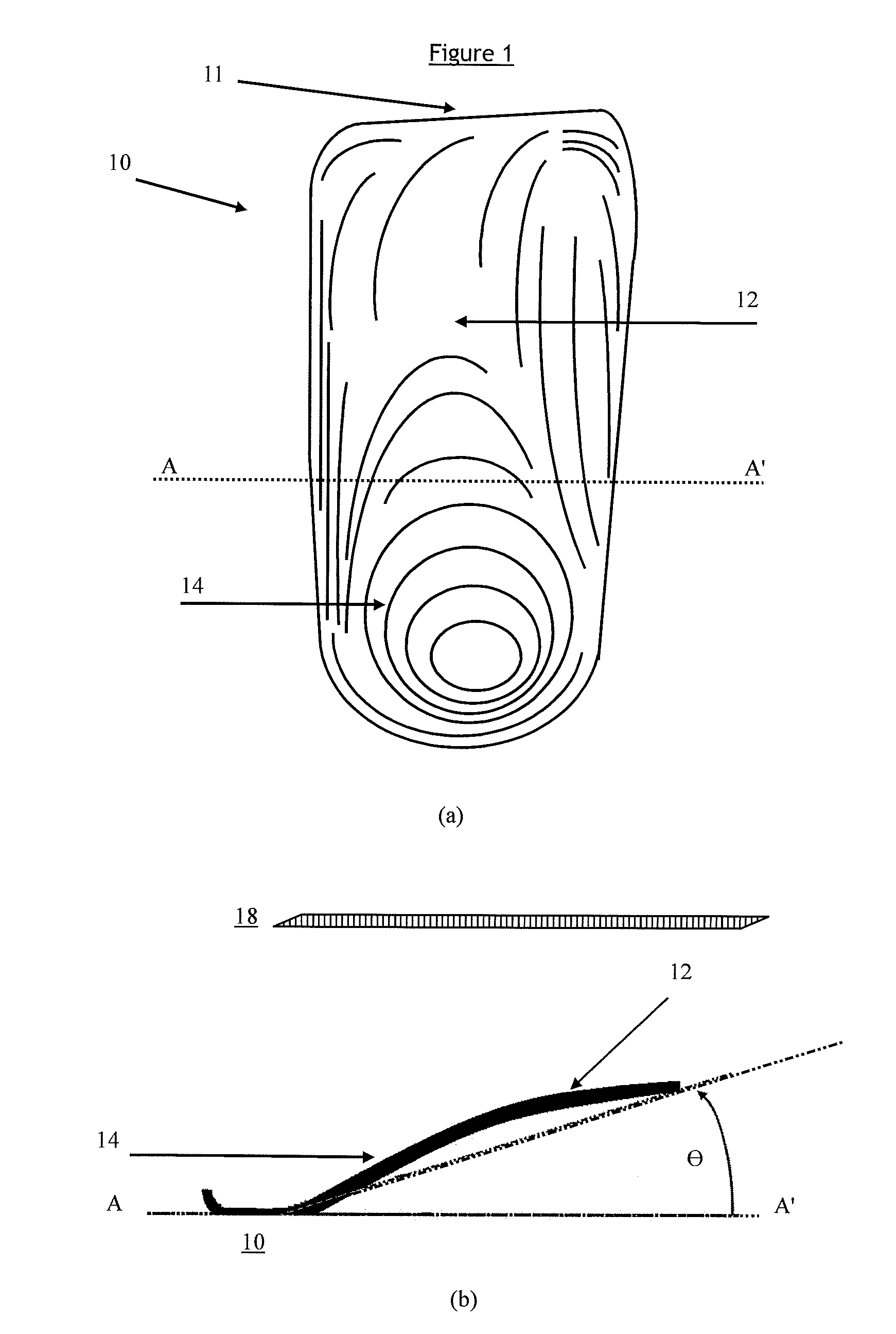 Orthotic Device and Method of Manufacture