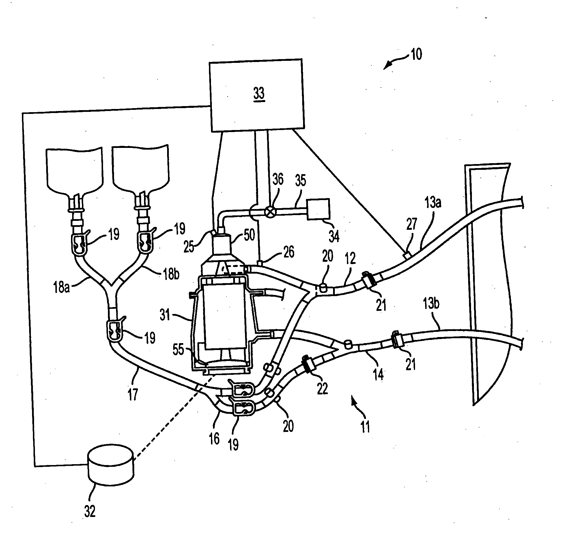 Extracorporeal blood handling system with automatic flow control and methods of use