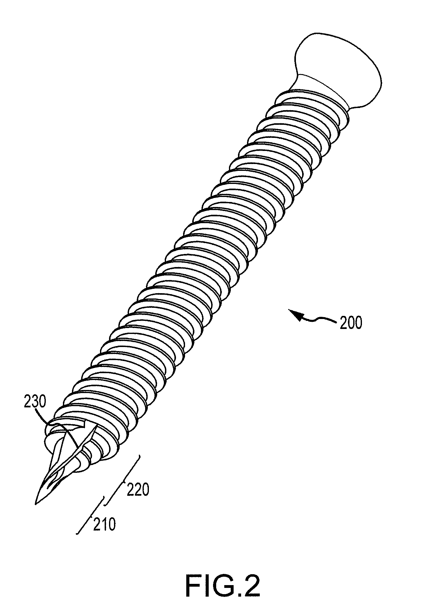 Image-guided minimal-step placement of screw into bone