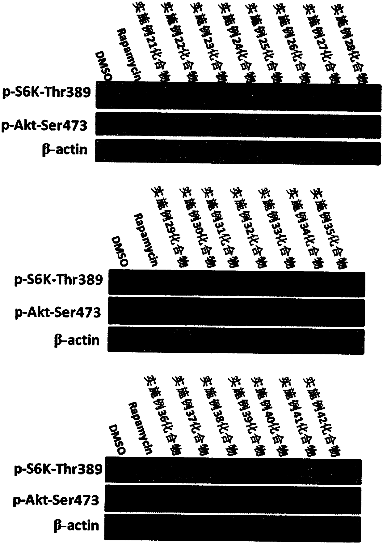 Novel thiazole derivative compound as well as preparation method, pharmaceutical composition and pharmaceutical application of novel thiazole derivative compound