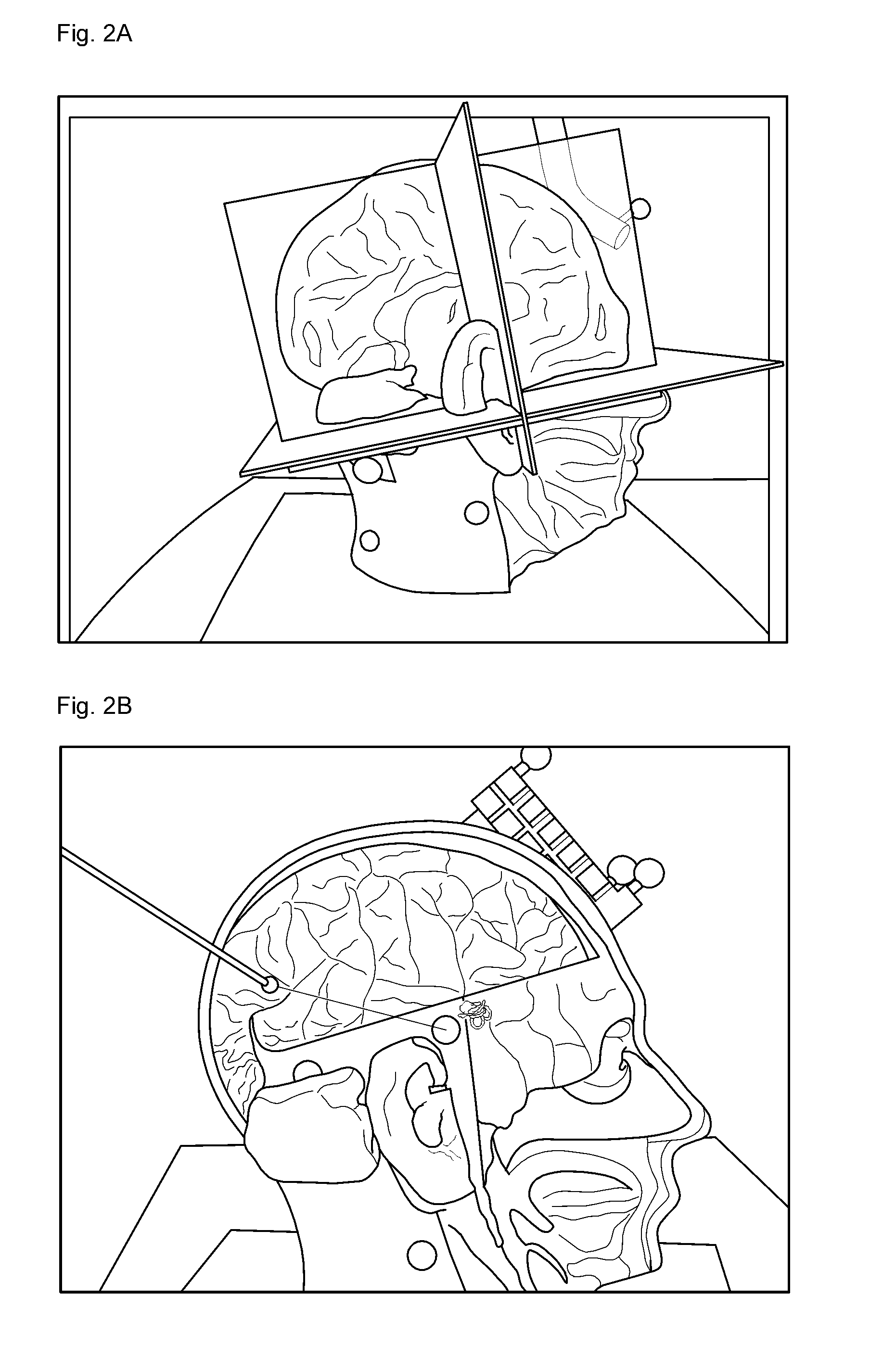 Method of operating a surgical navigation system and a system using the same