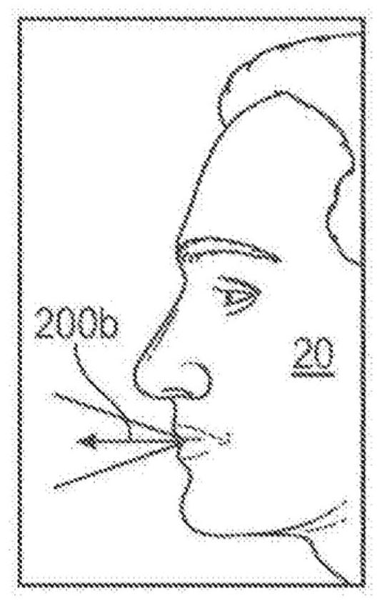 Nasal and oral respiration sensor