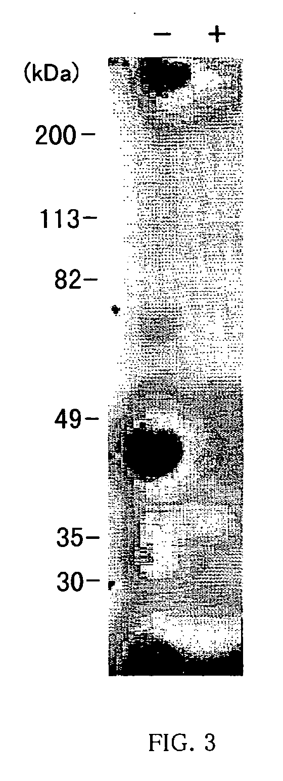 Method of treatment using anti-IL-18 antibody