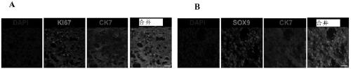 Method for preparing functional bile duct cells by using entoderm stem cells on scale and application of functional bile duct cells