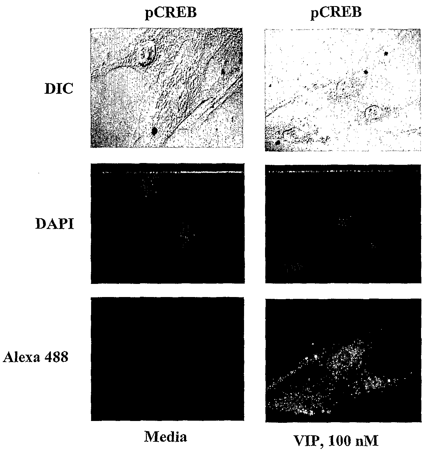 Methods and Compositions Involving A1c Subunit of L-Type Calcium Channels in Smooth Muscle Cells
