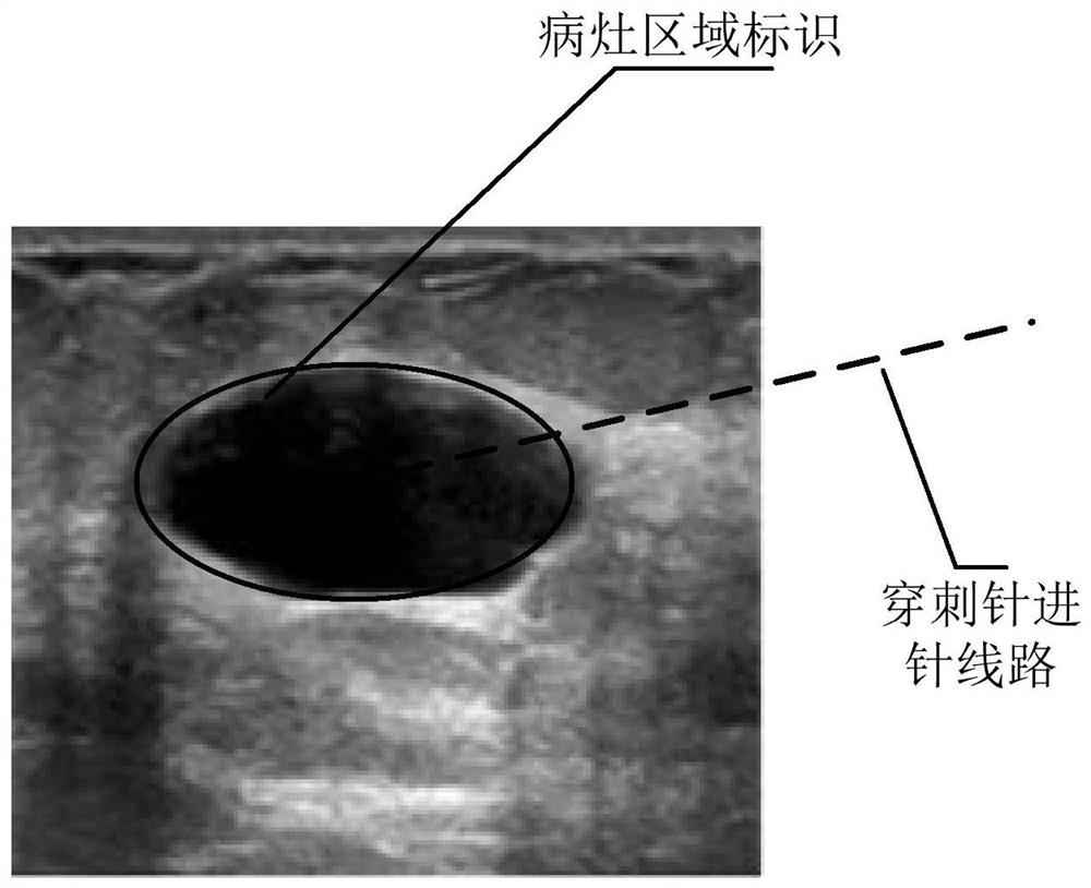 Image processing method of ultrasound images, ultrasound equipment and storage medium