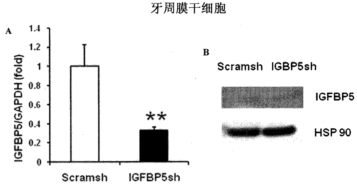 Application of insulin-like growth factor binding protein 5 in promoting periodontal tissue regeneration