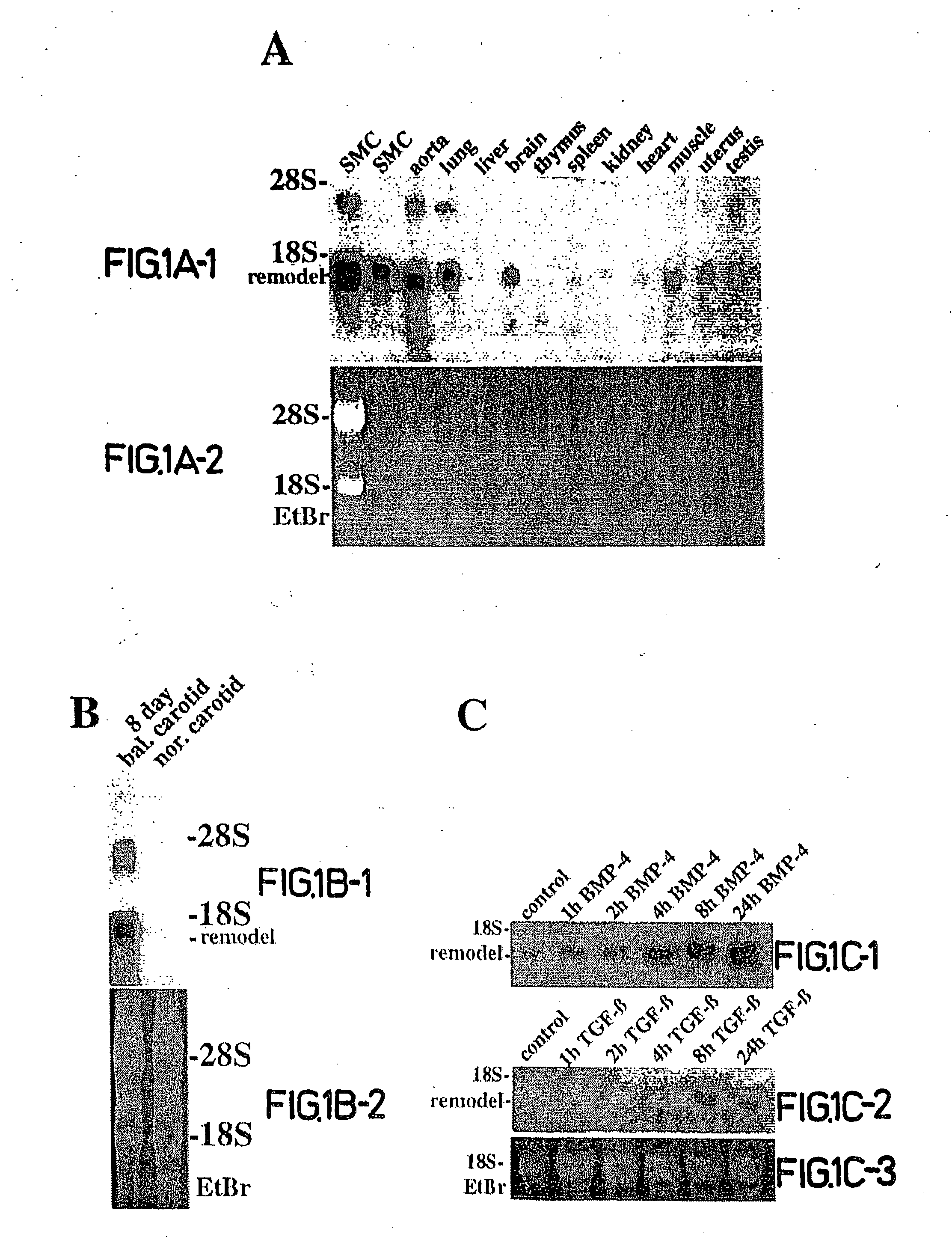 Compositions, methods and kits relating to CTHRC1, a novel modulator of collagen matrix