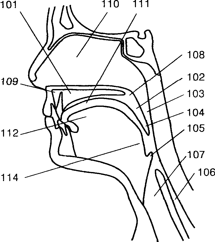Embedded soft palate supporter and embedding method thereof