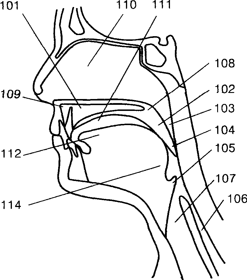 Embedded soft palate supporter and embedding method thereof