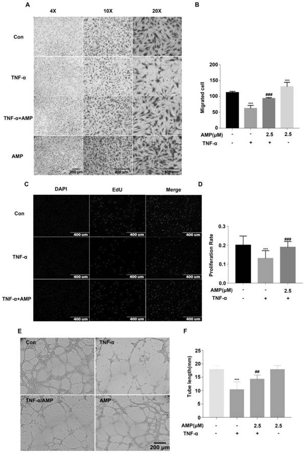 Application of amitriptyline to preparation of medicine for improving endothelial cell functions