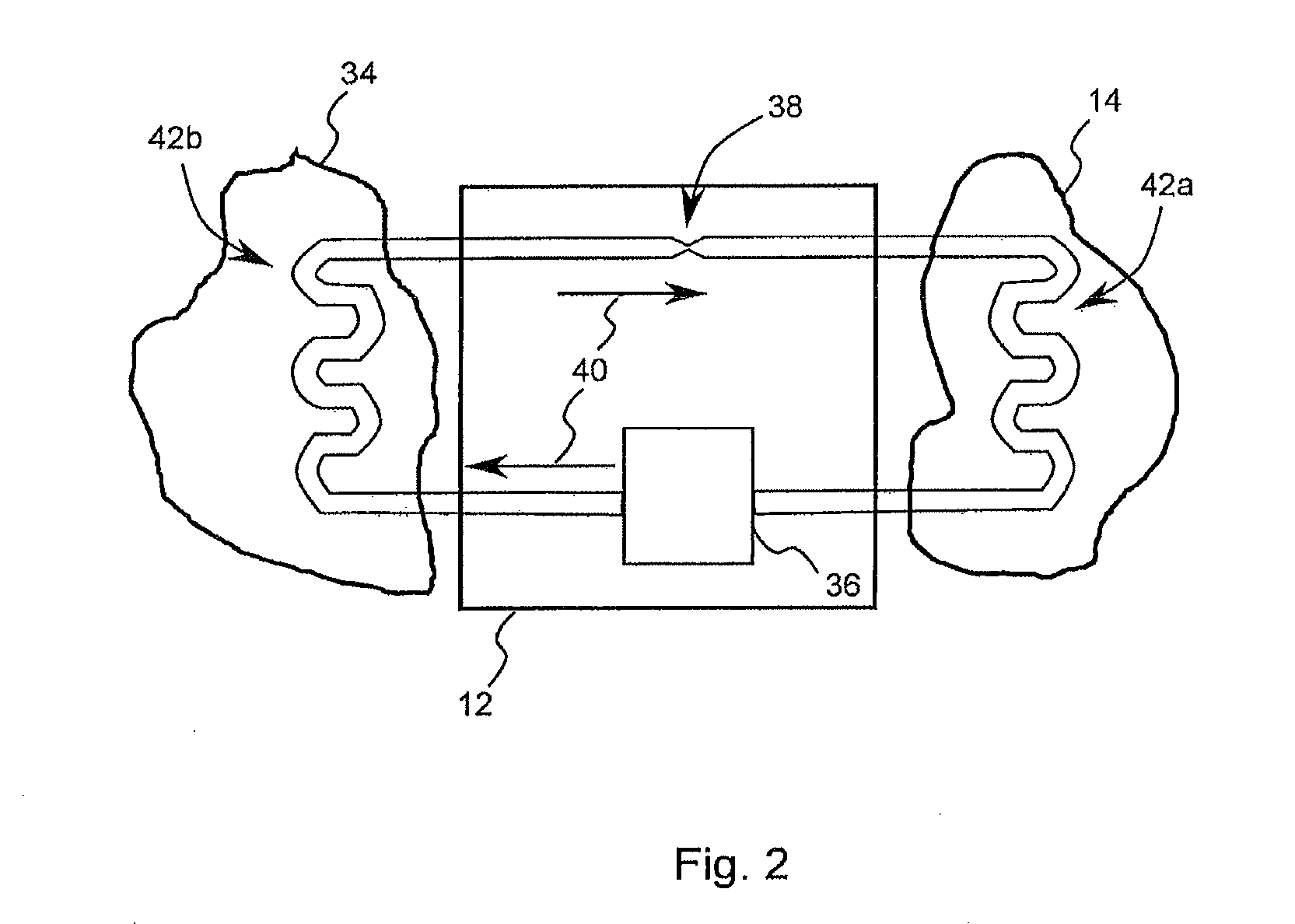 Dialysis device and method for operating a dialysis device