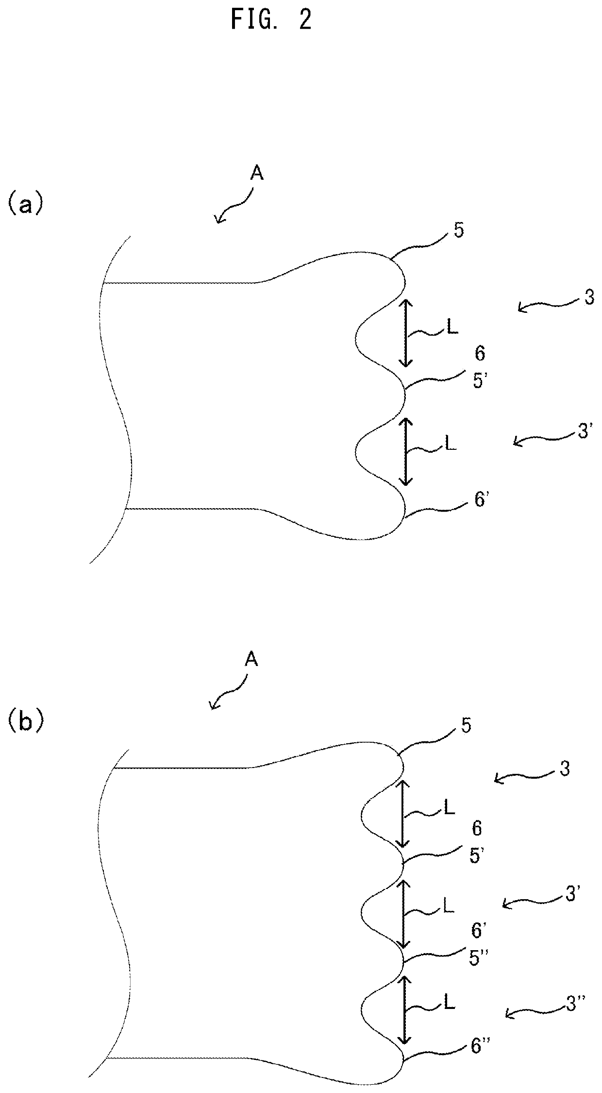 Subcutaneous tissue therapy treatment device