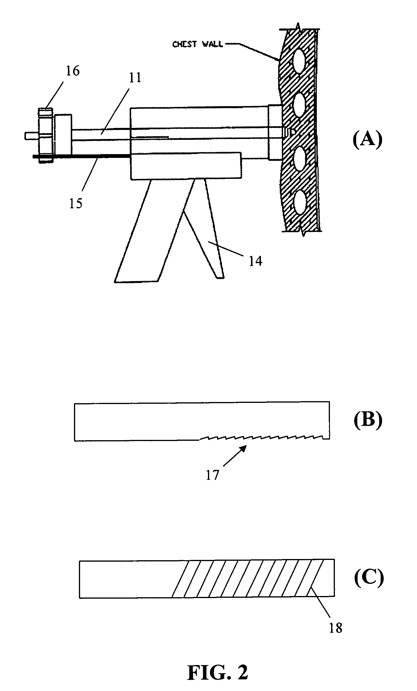 Apparatus and methods for safe and efficient placement of chest tubes