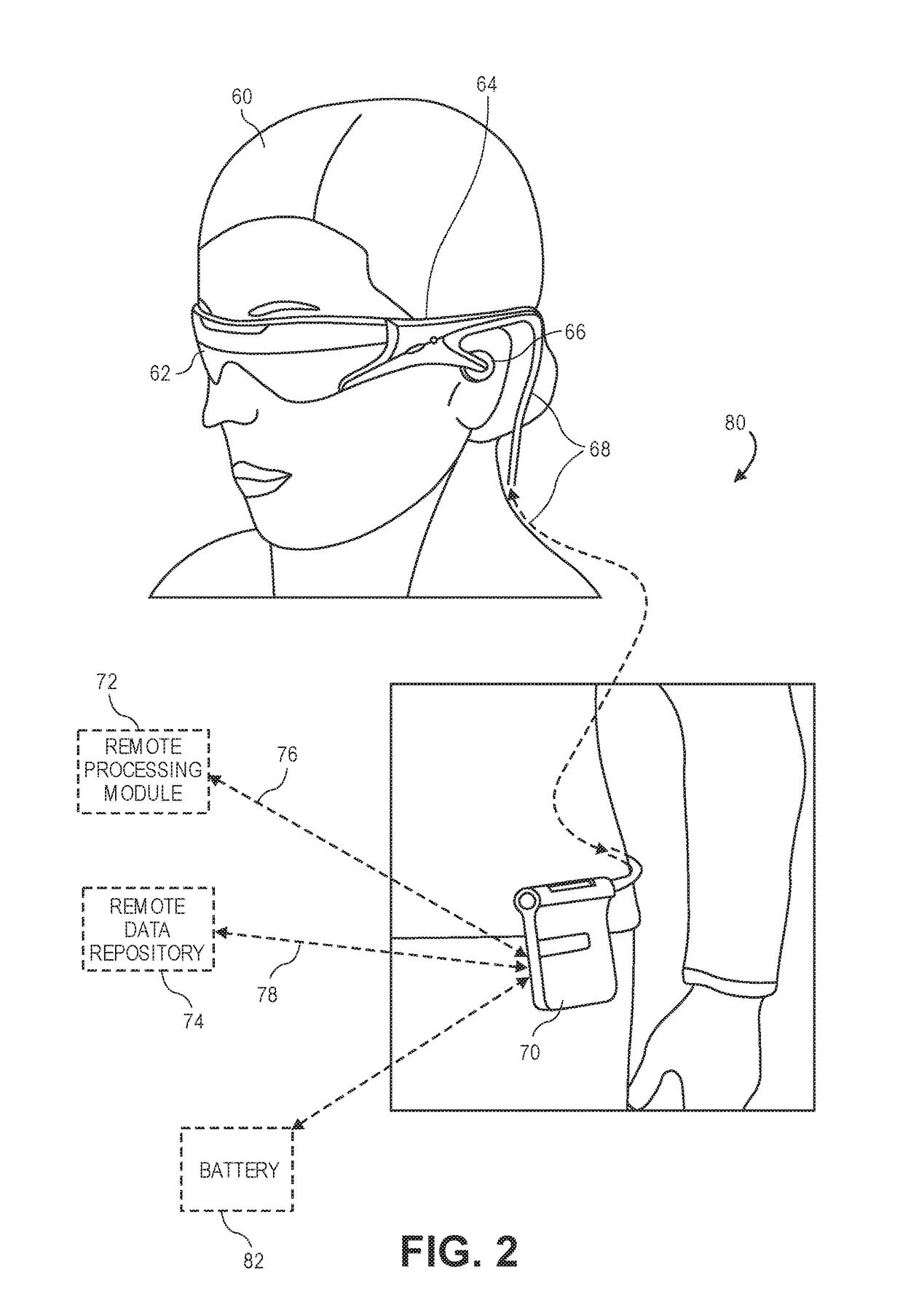 Continuous time warp and binocular time warp for virtual and augmented reality display systems and methods