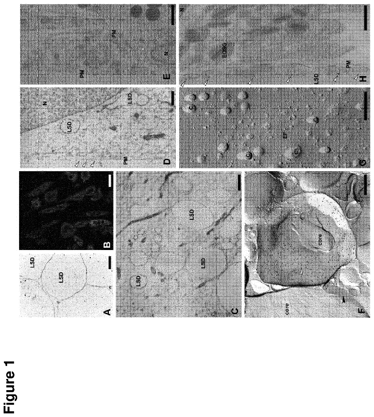 Means for specifically eliminating perilipin-1 fragment presenting adipocytes