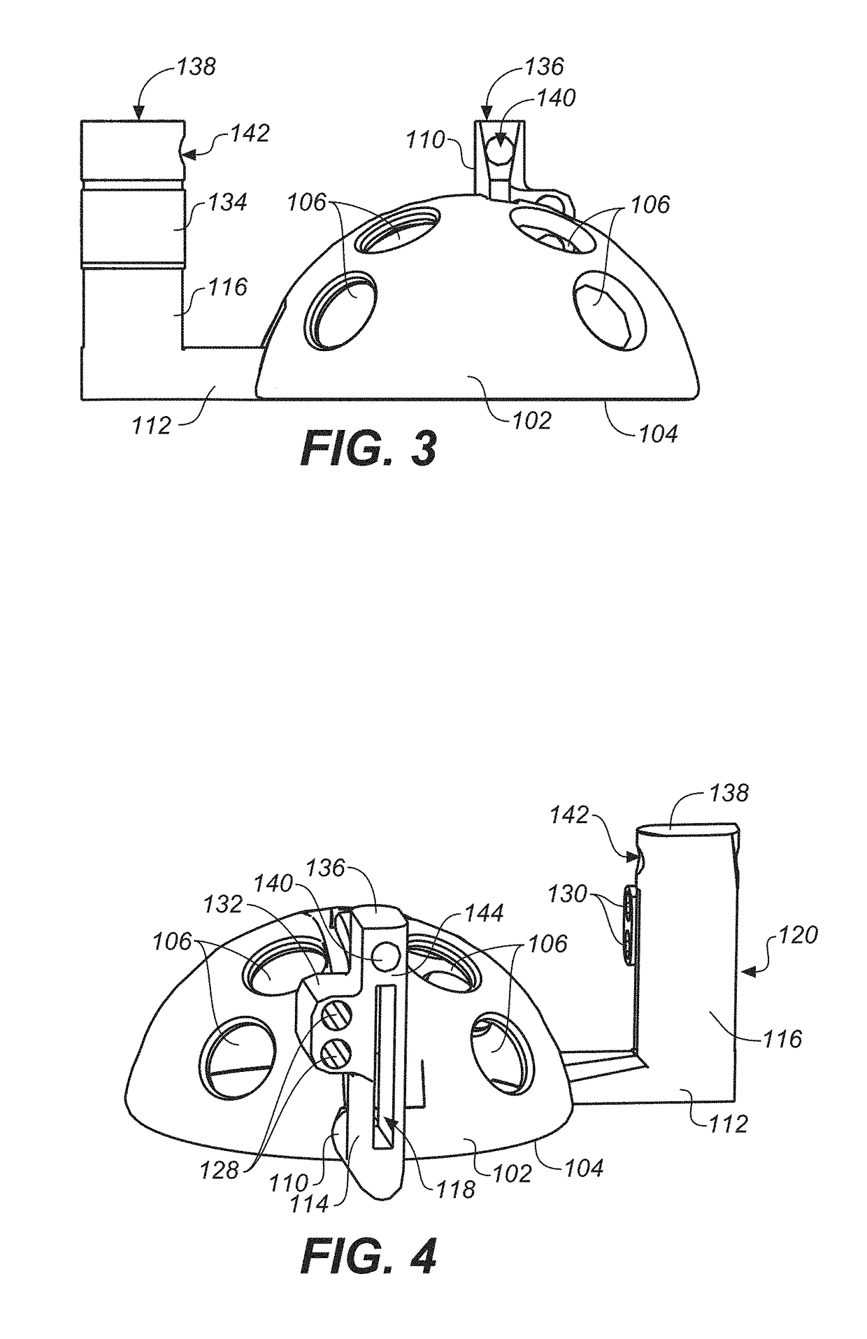 Bone cutting guide system for osteochondral transplantation