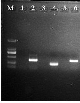 Method for constructing suppression subtractive hybridization (SSH) library of oryza rufipogon threatened by bacterial blight germs