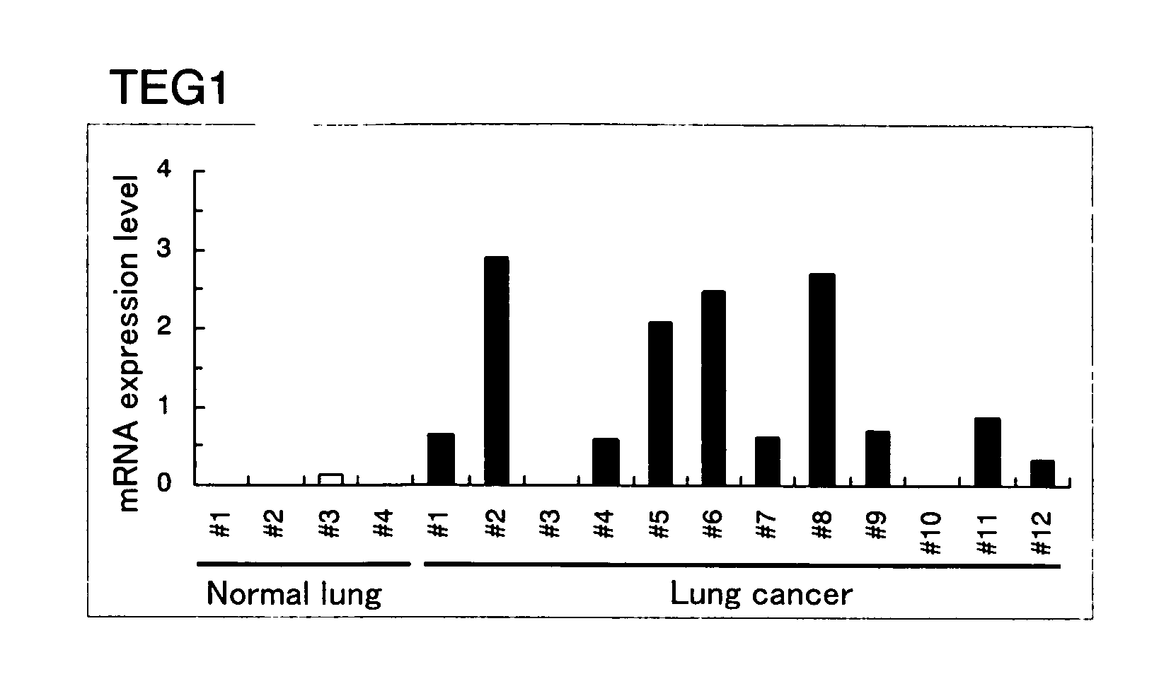 Gene Overexpressed in Cancer