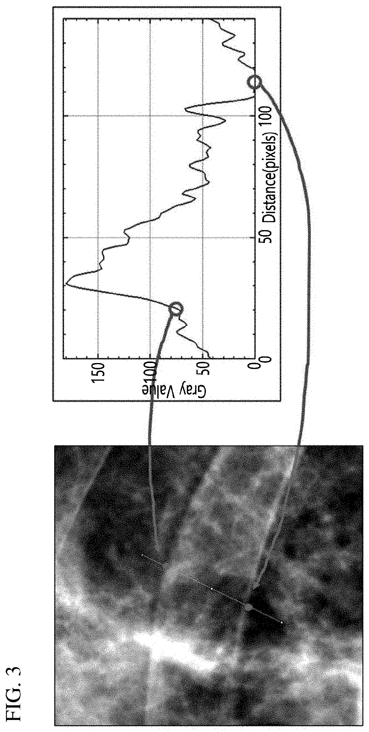 Method and apparatus for bone suppression in x-ray image