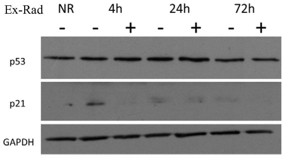 A kind of benzimidazole derivative and its preparation method and application