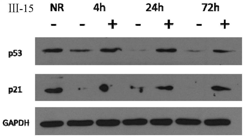 A kind of benzimidazole derivative and its preparation method and application