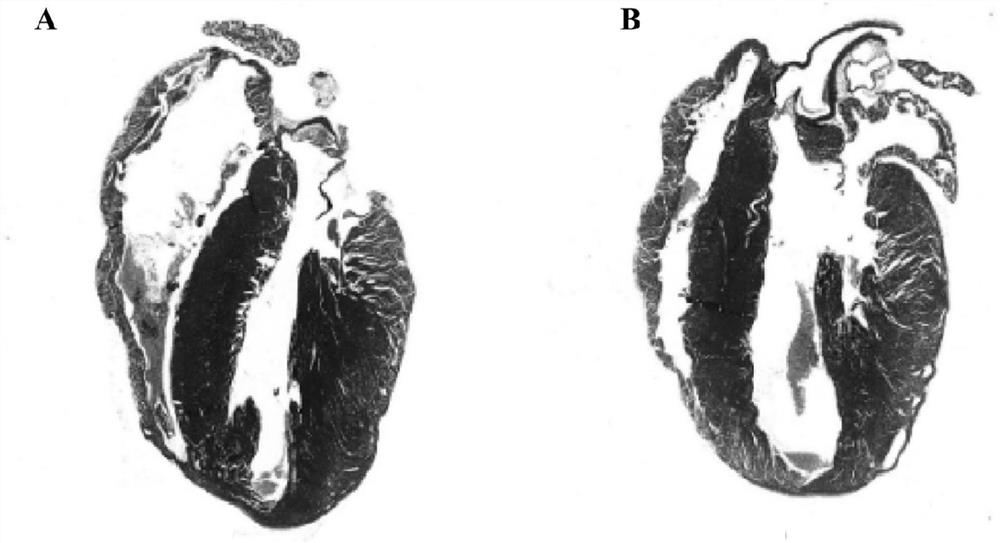 Pharmaceutical application of beta-catenin specific inhibitor