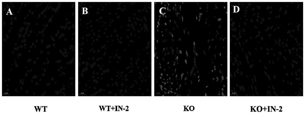 Pharmaceutical application of beta-catenin specific inhibitor